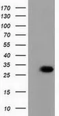 Anti-PBLD antibody [7G5] used in Western Blot (WB). GTX83938