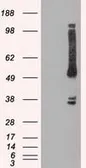 Anti-OXSR1 antibody [1F3] used in Western Blot (WB). GTX83951
