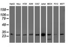 Anti-OTUB2 antibody [11B3] used in Western Blot (WB). GTX83953