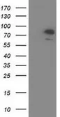 Anti-OSBPL11 antibody [6A6] used in Western Blot (WB). GTX83960