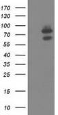 Anti-OSBPL11 antibody [6H9] used in Western Blot (WB). GTX83963