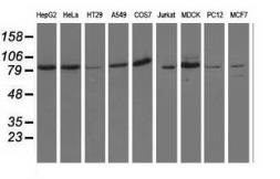 Anti-OSBPL11 antibody [7B3] used in Western Blot (WB). GTX83965