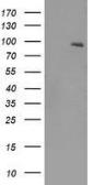 Anti-TrkB antibody [2E1] used in Western Blot (WB). GTX83980