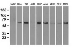Anti-NRBP1 antibody [7E2] used in Western Blot (WB). GTX84000