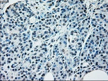 Anti-NRBP1 antibody [6C11] used in IHC (Paraffin sections) (IHC-P). GTX84003