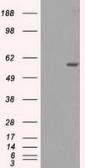 Anti-NRBP1 antibody [5C3] used in Western Blot (WB). GTX84007