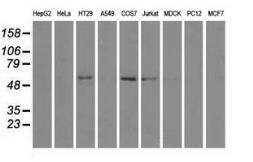Anti-NRBP1 antibody [5C3] used in Western Blot (WB). GTX84007