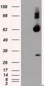 Anti-NPR-C antibody [2G2] used in Western Blot (WB). GTX84008