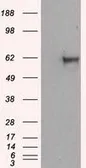 Anti-NPR-C antibody [11B5] used in Western Blot (WB). GTX84015