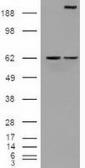 Anti-NOTCH1 antibody [3E12] used in Western Blot (WB). GTX84019