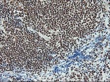 Anti-NOTCH1 antibody [4C9] used in IHC (Paraffin sections) (IHC-P). GTX84020