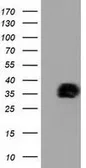 Anti-XLF antibody [3E5] used in Western Blot (WB). GTX84044