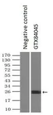 Anti-NGN3 antibody [5A8] used in Immunoprecipitation (IP). GTX84045
