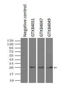 Anti-Neurogenin 1 antibody [10B10] used in Immunoprecipitation (IP). GTX84049