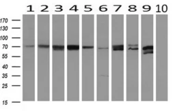 Anti-MTMR14 antibody [6B6] used in Western Blot (WB). GTX84079