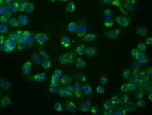 Anti-MSMB antibody [6C7] used in Immunocytochemistry/ Immunofluorescence (ICC/IF). GTX84083