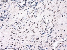 Anti-MRI1 antibody [6G9] used in IHC (Paraffin sections) (IHC-P). GTX84084