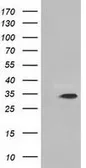 Anti-MIOX antibody [1C5] used in Western Blot (WB). GTX84112