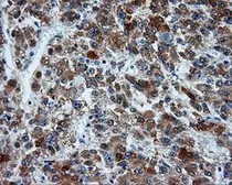 Anti-MCL1 antibody [10F6] used in IHC (Paraffin sections) (IHC-P). GTX84140