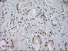 Anti-JNK1 antibody [2C6] used in IHC (Paraffin sections) (IHC-P). GTX84145