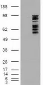 Anti-ERK3 antibody [1A9] used in Western Blot (WB). GTX84147