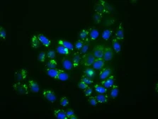 Anti-p38 beta antibody [1C2] used in Immunocytochemistry/ Immunofluorescence (ICC/IF). GTX84149