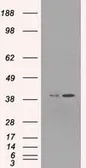 Anti-ERK2 antibody [6E5] used in Western Blot (WB). GTX84159