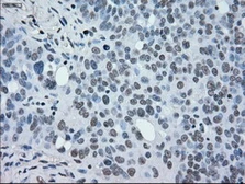 Anti-MEK2 antibody [5F6] used in IHC (Paraffin sections) (IHC-P). GTX84166