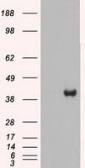 Anti-MEK2 antibody [5F6] used in Western Blot (WB). GTX84166