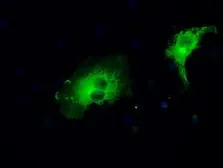 Anti-MEK1 antibody [1C1] used in Immunocytochemistry/ Immunofluorescence (ICC/IF). GTX84168