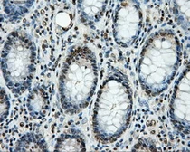 Anti-LOX antibody [6B11] used in IHC (Paraffin sections) (IHC-P). GTX84182
