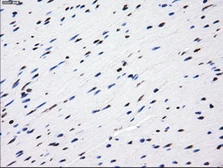 Anti-LOX antibody [9A11] used in IHC (Paraffin sections) (IHC-P). GTX84189