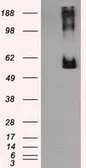 Anti-Endothelial Lipase / LIPG antibody [1B8] used in Western Blot (WB). GTX84209