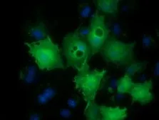 Anti-LIN7B antibody [1C9] used in Immunocytochemistry/ Immunofluorescence (ICC/IF). GTX84216
