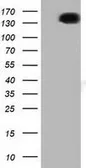 Anti-L1CAM antibody [2G9] used in Western Blot (WB). GTX84232