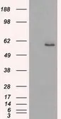 Anti-Cytokeratin 8 antibody [4D12] used in Western Blot (WB). GTX84248