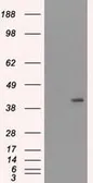 Anti-Cytokeratin 19 antibody [3F8] used in Western Blot (WB). GTX84251