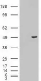 Anti-Cytokeratin 18 antibody [1E1] used in Western Blot (WB). GTX84256