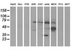 Anti-KLHL2 antibody [1G7] used in Western Blot (WB). GTX84259