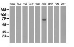 Anti-KLHL2 antibody [6D8] used in Western Blot (WB). GTX84261