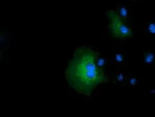 Anti-IVD antibody [5A11] used in Immunocytochemistry/ Immunofluorescence (ICC/IF). GTX84284