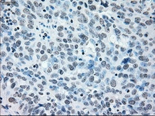 Anti-IRF3 antibody [5D2] used in IHC (Paraffin sections) (IHC-P). GTX84287