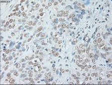 Anti-IL6 antibody [3G9] used in IHC (Paraffin sections) (IHC-P). GTX84291