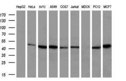 Anti-HIPPI antibody [4F6] used in Western Blot (WB). GTX84310