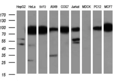 Anti-IFIT1 antibody [3G8] used in Western Blot (WB). GTX84315