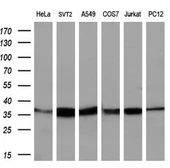 Anti-IDH3A antibody [5D2] used in Western Blot (WB). GTX84318
