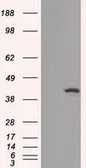 Anti-IDH1 antibody [2H9] used in Western Blot (WB). GTX84319