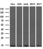Anti-ID3 antibody [10D3] used in Western Blot (WB). GTX84325