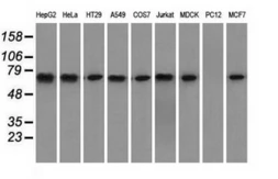 Anti-Hsp70 antibody [3C6] used in Western Blot (WB). GTX84338
