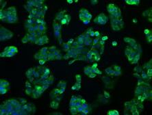 Anti-ERAB antibody [11A2] used in Immunocytochemistry/ Immunofluorescence (ICC/IF). GTX84347